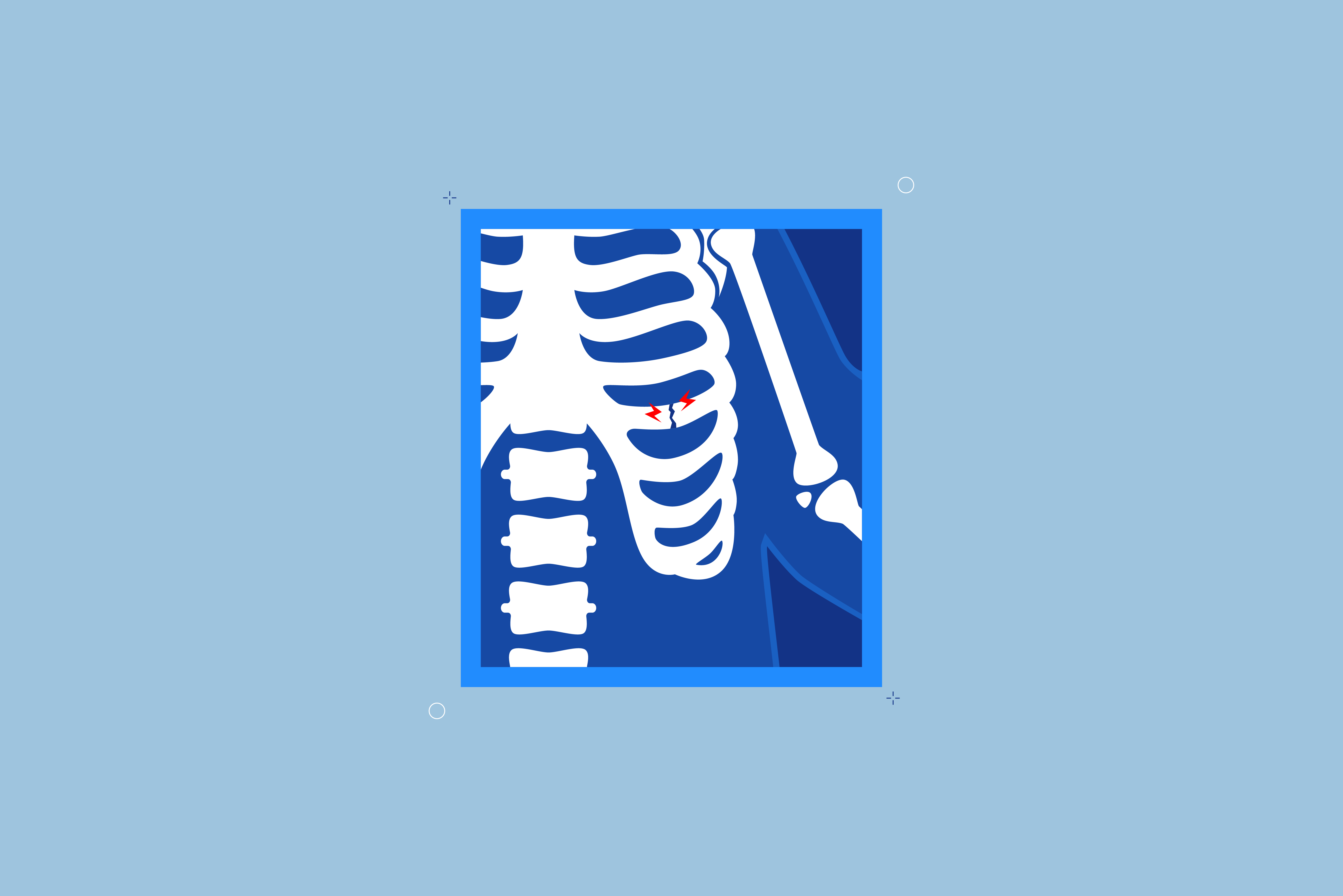 How to Sleep with Broken Ribs